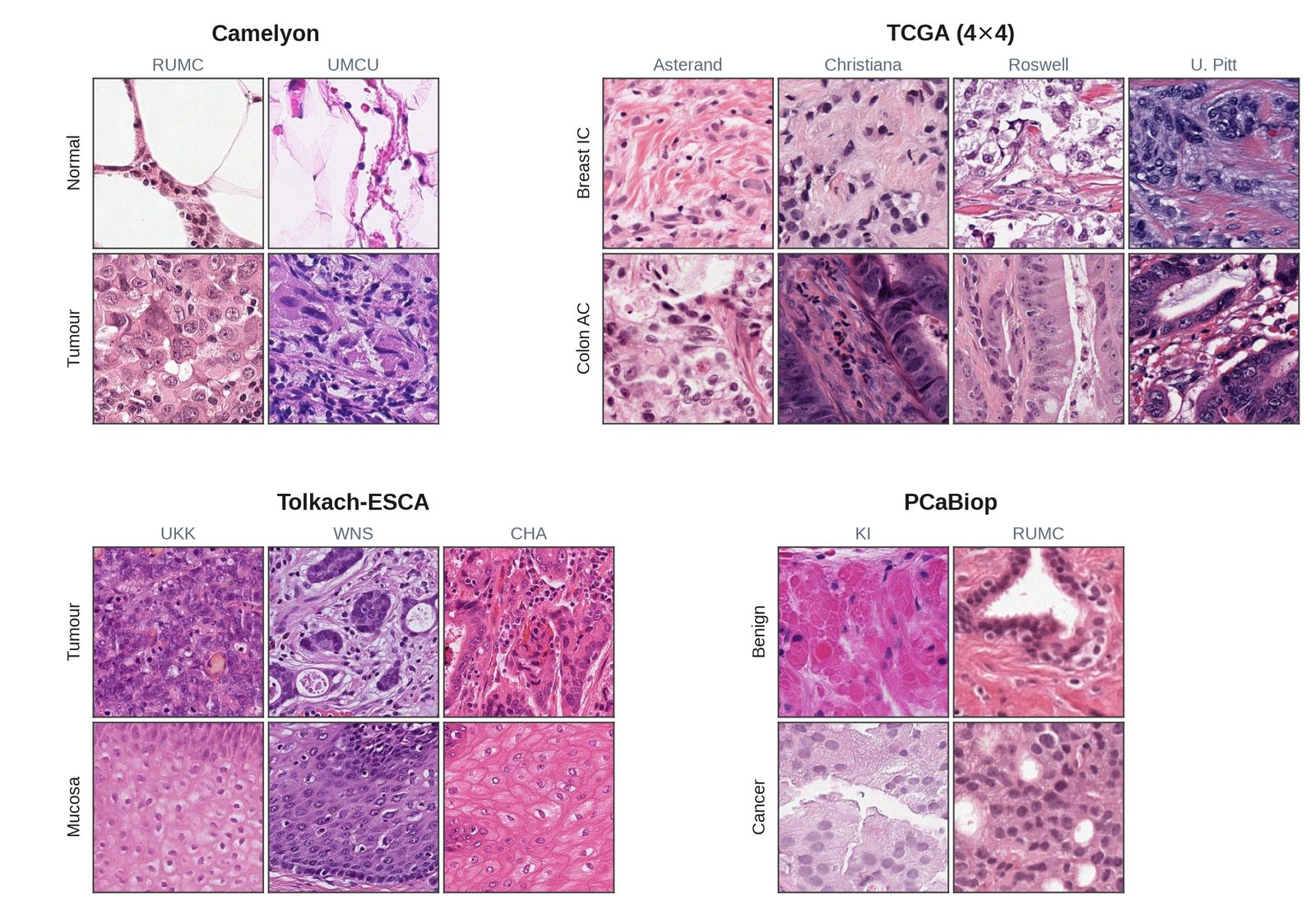 Example tiles per benchmark, arranged by biological class and by center.